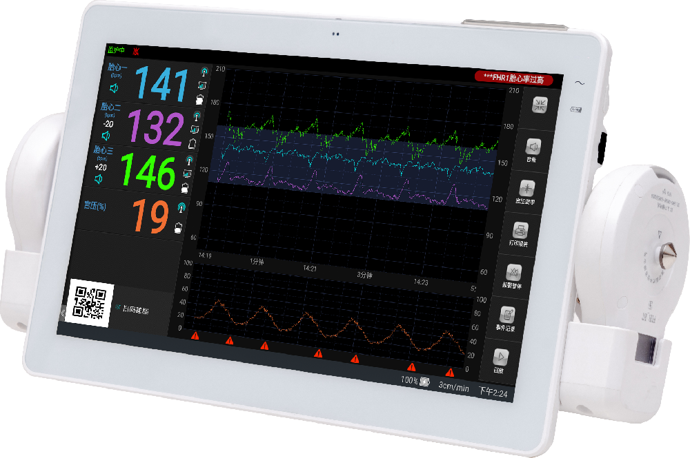 Lian-med Intelligent Fetal Monitoring System